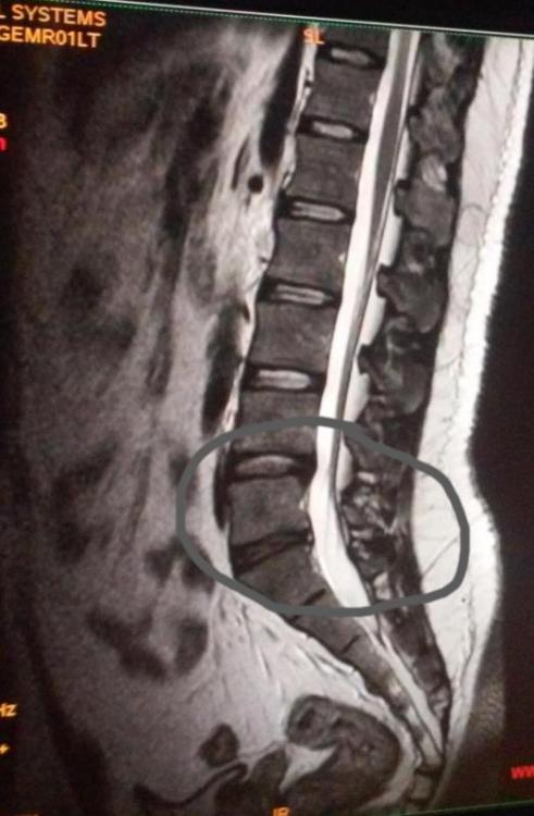 post-30293-0-00994700-1424972849_thumb.j