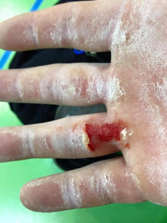 post-18503-0-84964400-1425836538_thumb.j