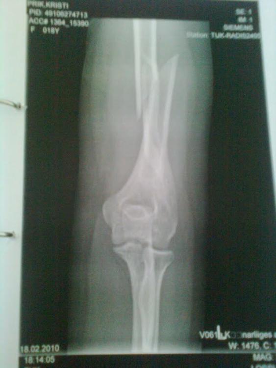 post-36794-0-08792400-1428923898_thumb.j