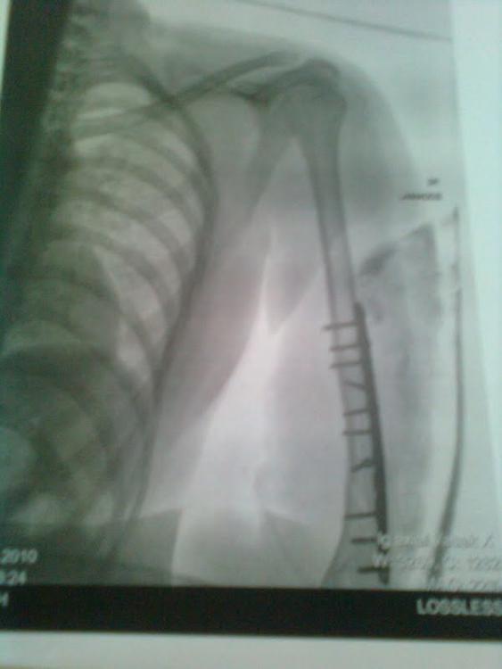 post-36794-0-85137000-1428923891_thumb.j