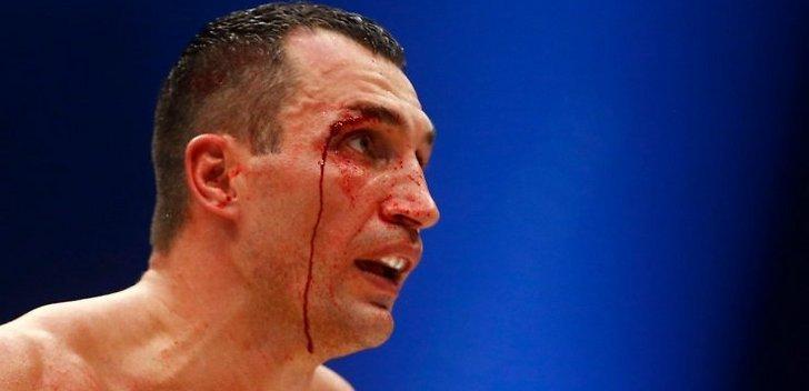 post-26029-0-19906300-1449053120_thumb.j